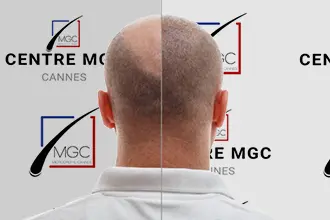 avant apres centre mgc